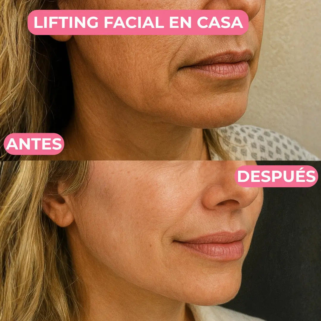 Lumea® Masajeador Eléctrico